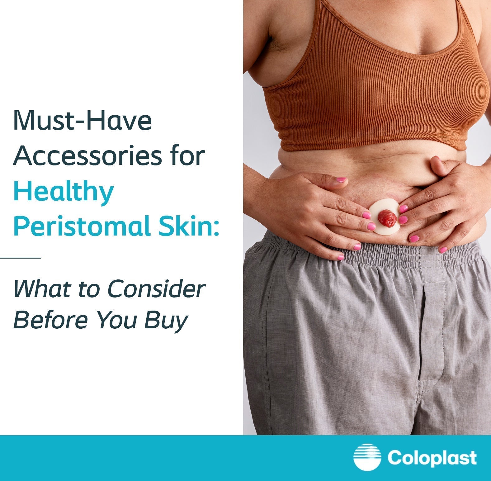 Must-Have Accessories for Healthy Peristomal Skin: What to Consider Before You Buy