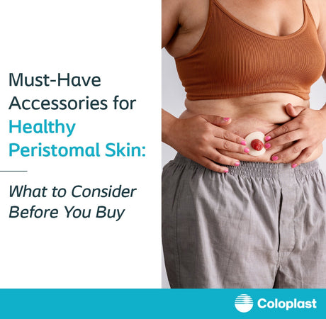 Must-Have Accessories for Healthy Peristomal Skin: What to Consider Before You Buy