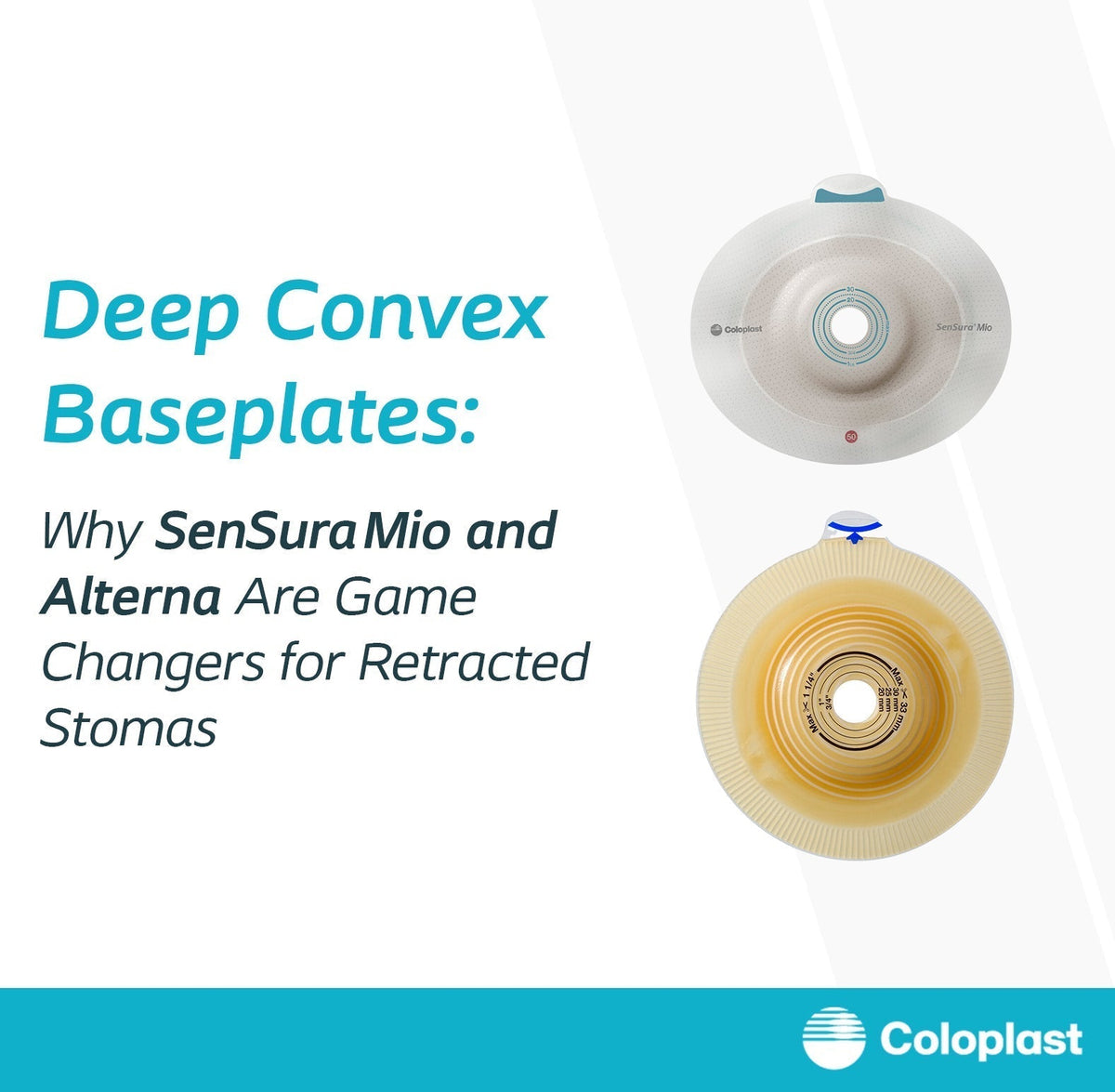 Deep-Convex Baseplates for Retracted Stomas: SenSura Mio & Alterna Guide