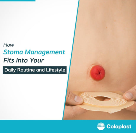 Stoma Management and Daily Routine Guide