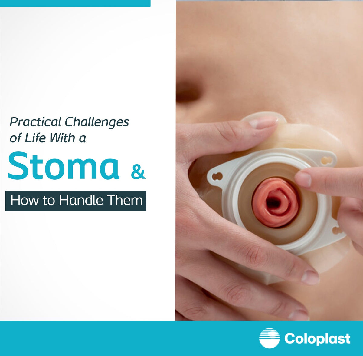 Stoma care Tips